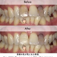 画像251