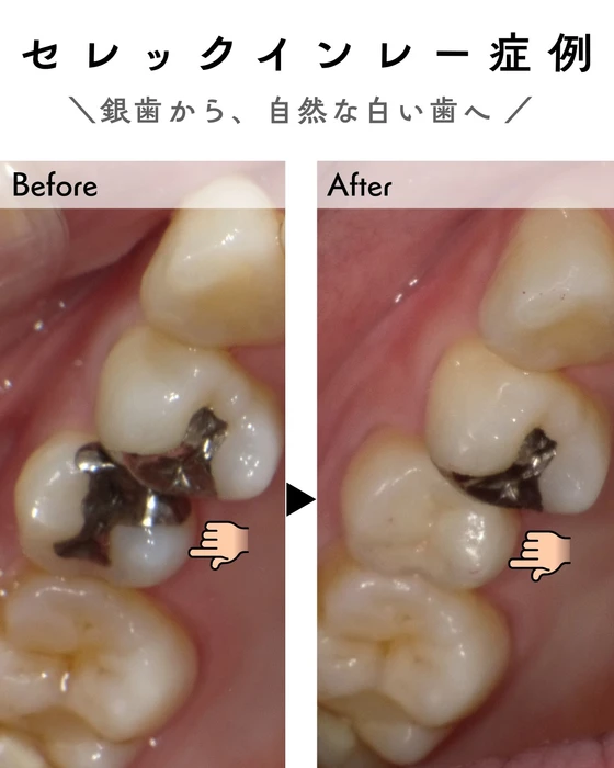 画像261
