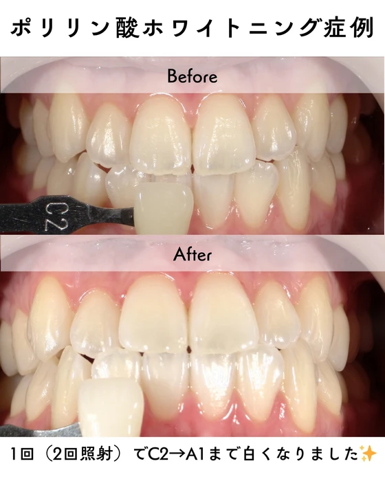 画像300
