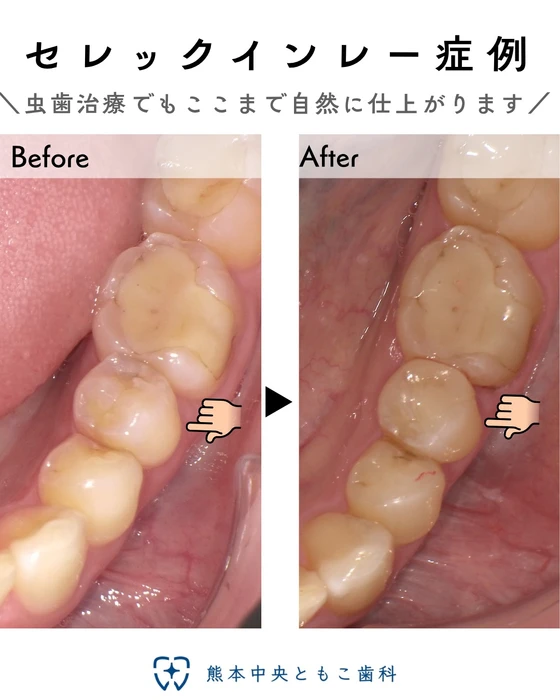 画像309