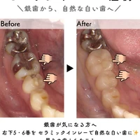 画像316