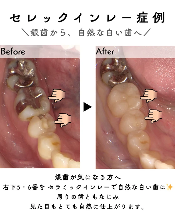 画像316