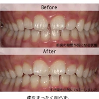 画像325