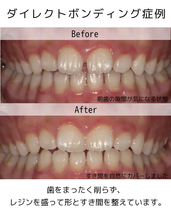画像325