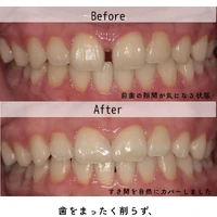 画像351