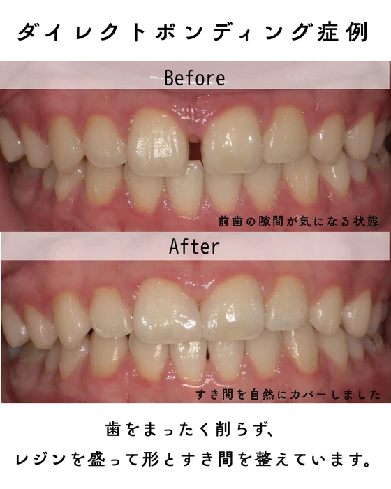 画像351